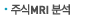 �ֽ� MRI �м�